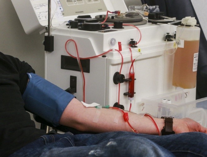 Plasmapheresis​